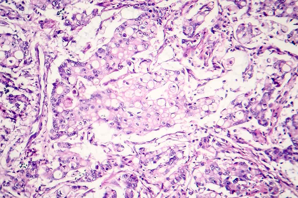 shutterstock_1184856772